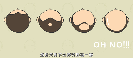 人为什么会秃顶