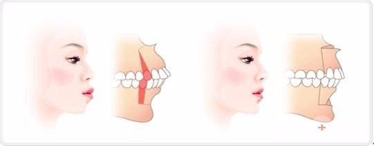 错颌畸形的矫治目标是什么？