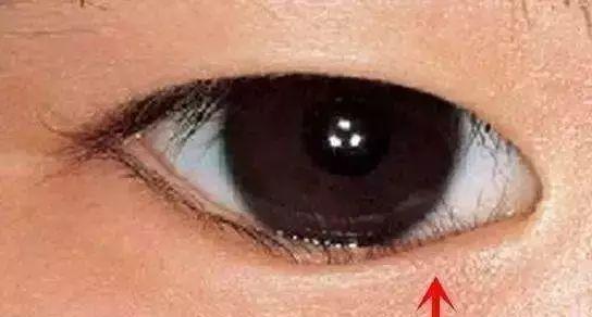 看到宝宝使劲揉眼睛，你的第一感觉是什么？