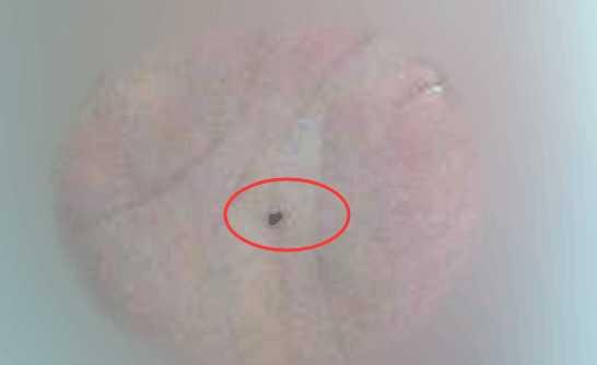 这六个地方长痣的女人最富贵,财运好,身体棒,能