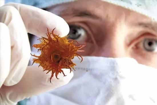 乙肝爸爸小心 孩子刚出生千万别亲亲!