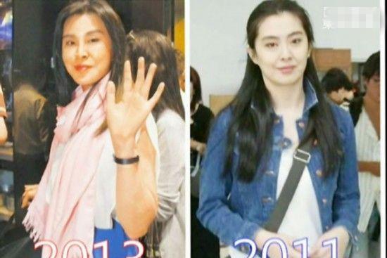 王祖贤出过一次车祸，可以查查，要不不会变化那么多？