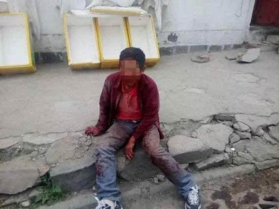 女儿嫌弃父亲是弱智不认他,街上遇到小流氓,看