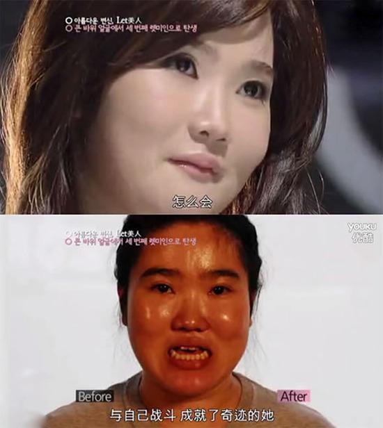 直击8位韩国丑女整容前后对比照丑女瞬间变成了大美女