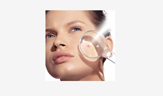 长痘不防晒,皮肤会受损这么严重?