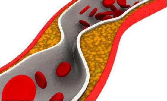 甘油三酯高吃什么食物会比较好些的啊?