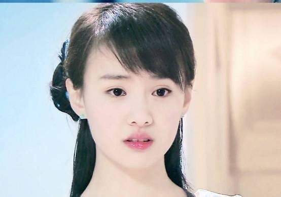 郑爽整容前后对比照片,她要是看了一定会后悔的