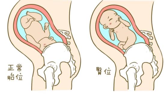 当胎儿打嗝时,准妈妈会有怎样的感觉?你知道吗