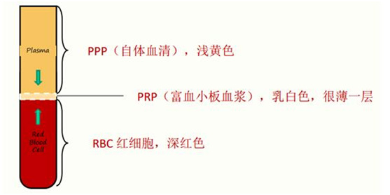 关于PRP自体脂肪填充你不知道的一切|微整形