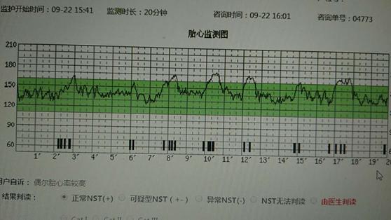 在胎心监护的20分钟内,胎心有一个比较稳定的速度基线,在120～160次
