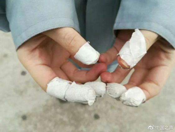 不实习就不能毕业?有学生想死,校方回应