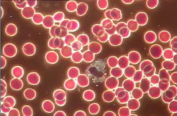 女人不来月经,身体就不能排毒吗?月经里到底有