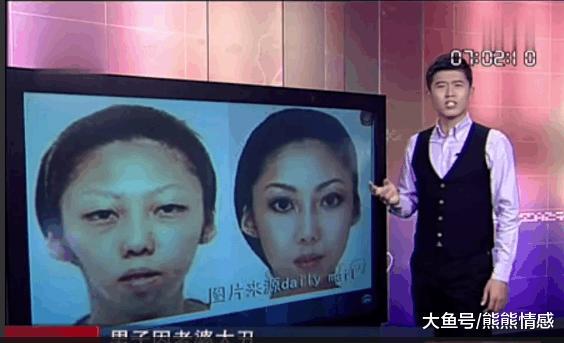 男子因为妻子太丑将妻子告上法庭, 获得75万赔