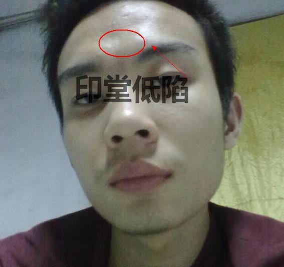 山根低陷,鼻柱而又凹凸,枯骨,平塌无势,有恶痣等都是不好的面相
