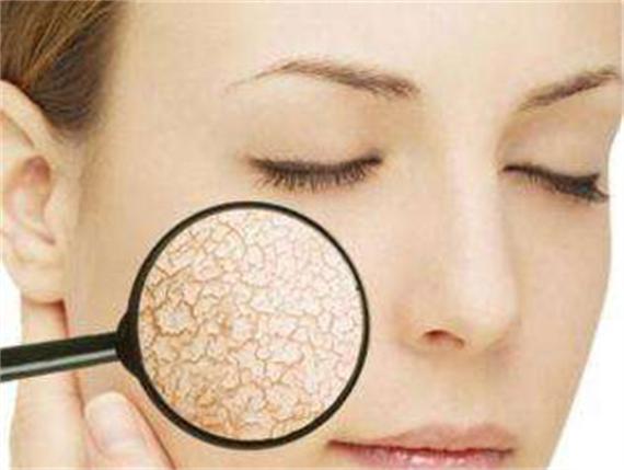 补水后脸上泛红刺痛为什么 这种情况怎么办