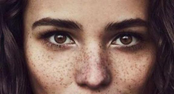 脸上的黑色素多?再不排除,小心很快堆积成色斑