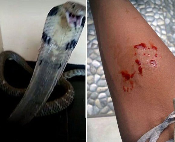 印尼少年饲养宠物毒蛇,不幸被咬后发照片求救,最后