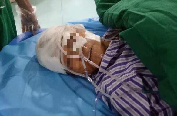 狼狗咬掉女路人头皮!狗主人吓到直接跑,丢下恶犬!