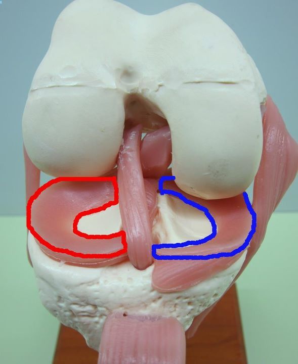 祖传小秘方,专攻半月板损伤!别再乱吃药了,用过