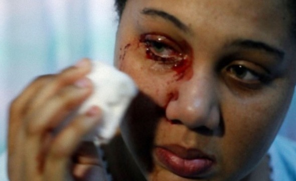 印度女子有特异功能,眼睛一哭流鲜血,专家终于