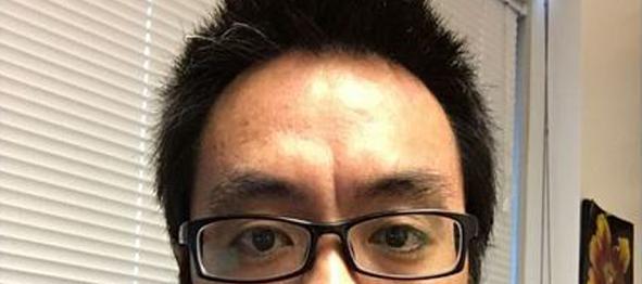 印堂悬针 一,印堂悬纹 此为印堂悬针,纹理愈清晰愈深愈长就愈凶,煞气