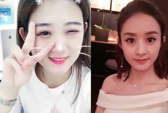 她花了100万想整容成迪丽热巴!咋知道却变成了女版