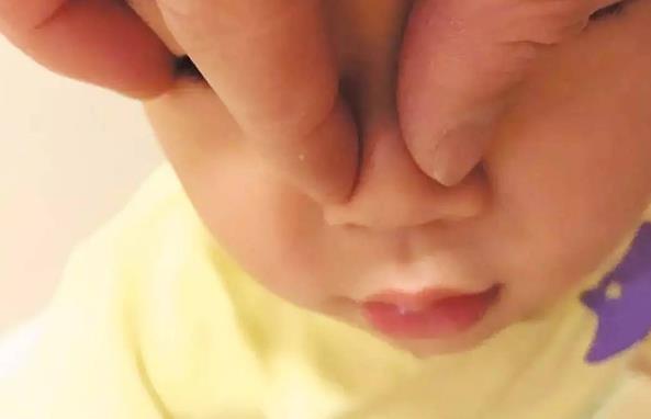 婴幼儿护理：宝宝塌鼻子，捏一捏就能变成“高鼻梁”吗？
