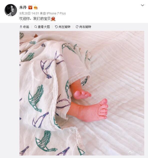 新晋妈妈朱丹素颜照脱发严重，网友：周一围红了，你快熬出来了