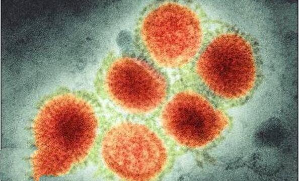 世界上10大最恐怖的病毒,第一让近数亿人死亡
