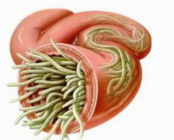 六岁的男孩肚子痛去医院检查,检查后才知道是