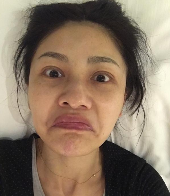 舒淇晒过敏, 这年头女明星流行素颜自拍