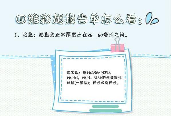 四维彩超怎么看?可以看出宝宝性别?看了这个
