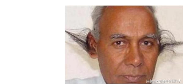 只要此处长毛的男人,必定一生长寿且富贵,中