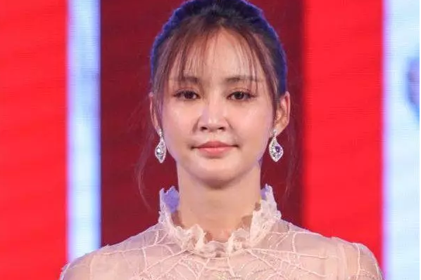 袁弘老婆张歆艺整容失败,现在脸部浮肿丑哭众