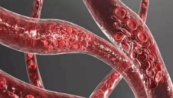 输液管里进气泡会要人命吗? 药水输完了忘记拔