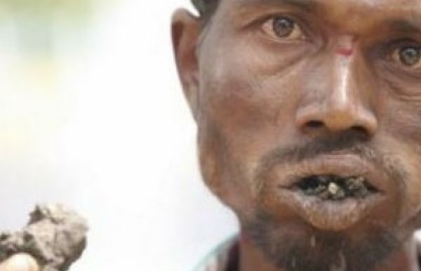 男子20年不吃饭,坚持每天吃砖头,为什么能活到