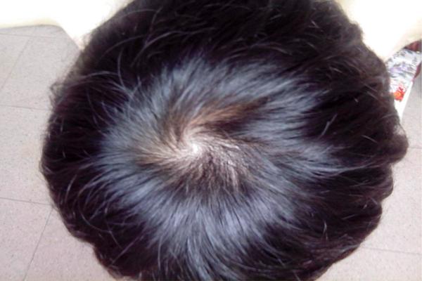 农村老话说一旋拧,俩旋横,仨旋打架不要命,头