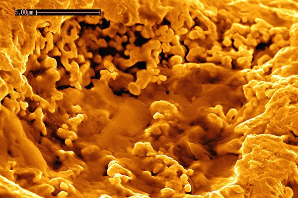 神奇细菌吞噬重金属化合物可排出24K纯金
