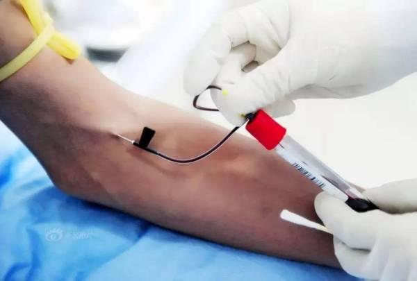 采完动脉血气,手肿像鸡蛋!面对这种情况,我们应