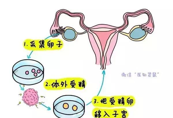 武汉供卵试管婴儿要取多少卵子才可以怀孕？