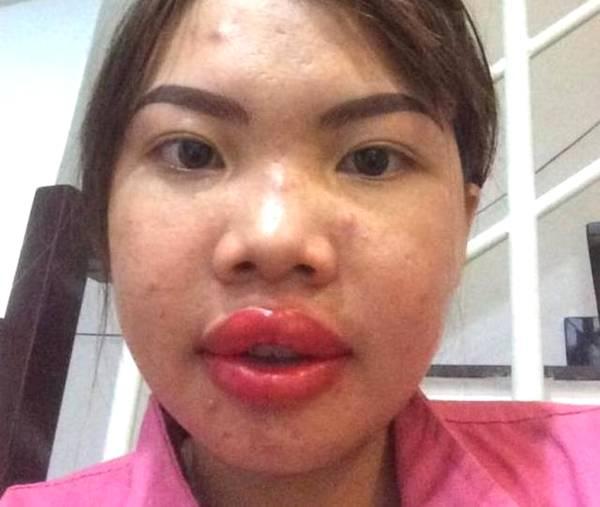 太丑没人娶整容后从丑女逆袭成女神成功嫁给了富二代