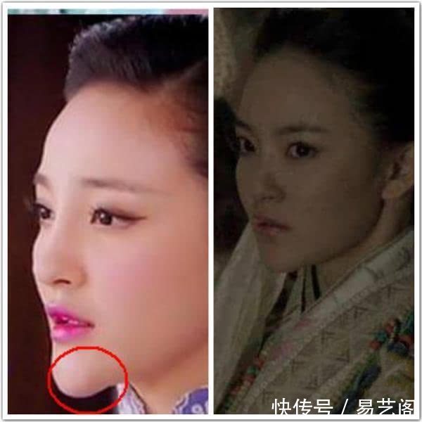 女人下巴解读一生运势,预示福多财旺的这颗吉痣,你有吗?