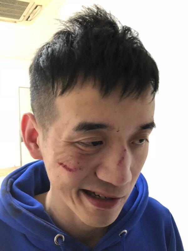 调戏陈同学的网红蛋蛋在杭州发文被打，微博评论却让他火了!