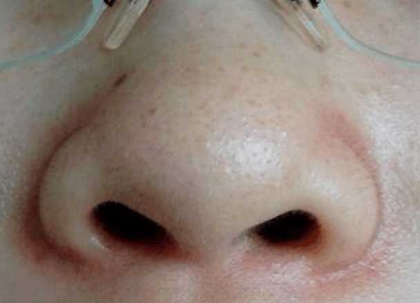 脾胃不好就会出现这几种症状, 看看自己