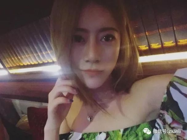 隆鼻前后对比，差别竟然如此大