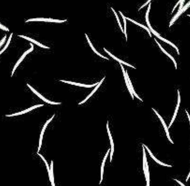 什么是蛲虫病?为什么儿童易患蛲虫病?