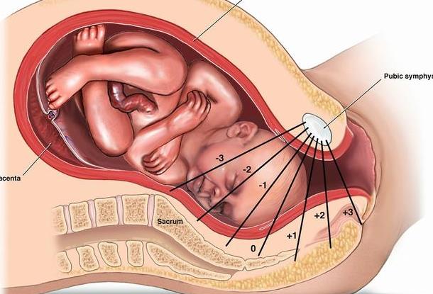 入盆图片_纵览新闻