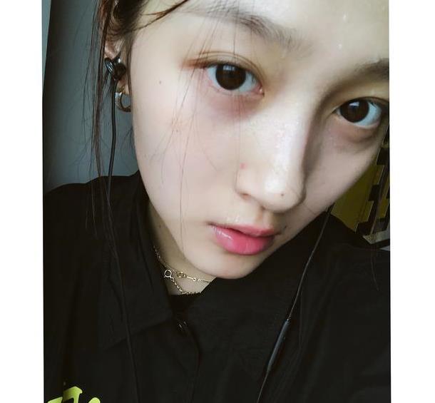 关晓彤深夜暴击,在Ins上晒素颜运动照,脸上的青