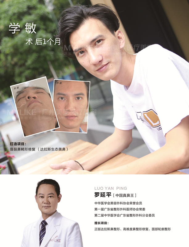 罗延平鼻修复技术成果亮相鼻高峰论坛备受瞩目