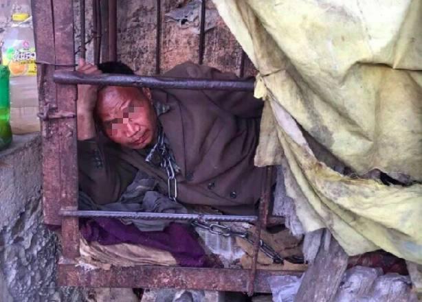 精神病男子上街发病,过路女孩遭毒手,事后他被套麻袋打断腿